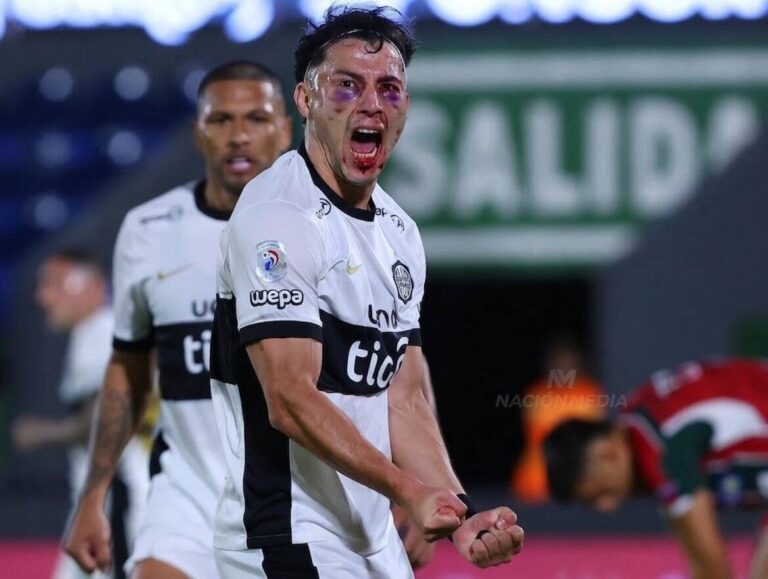 (GALERÍA) El gol más ingueroviable ya tiene memes: «El verdadero caradura fui»