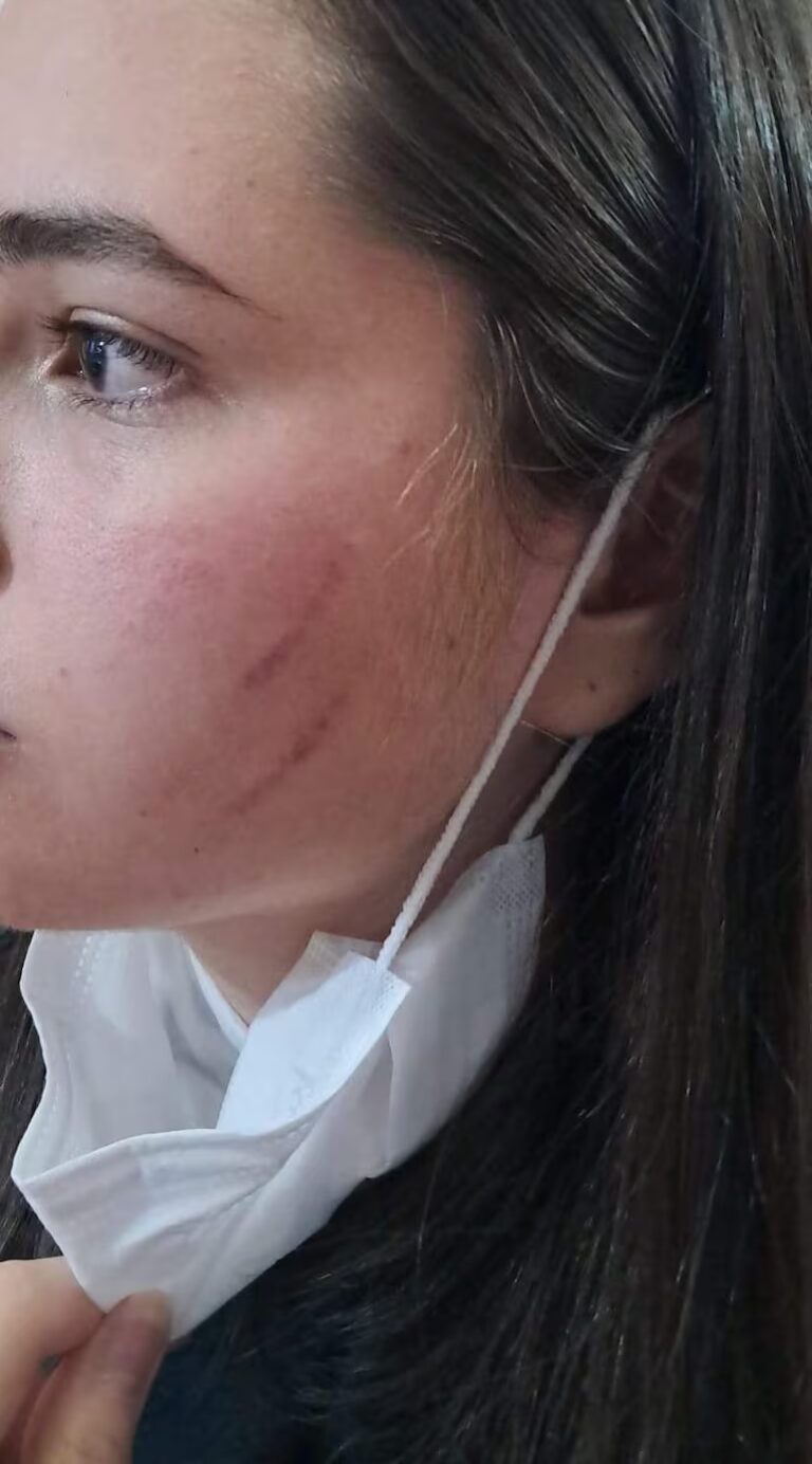 Santaní: denuncian a exdiputada Perla Acosta por supuesta agresión y anuncian querella