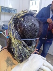 PJC: Peluquero golpeó a su pareja y le derramó cola de zapatero antes de huir