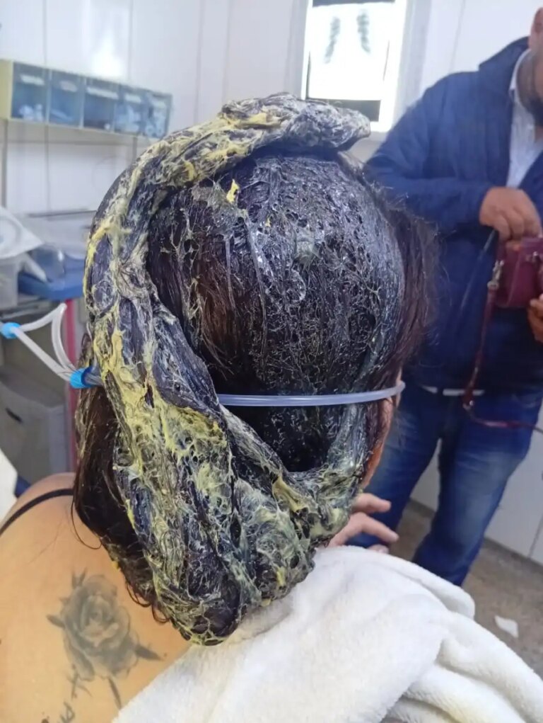 PJC: Peluquero golpeó a su pareja y le derramó cola de zapatero antes de huir