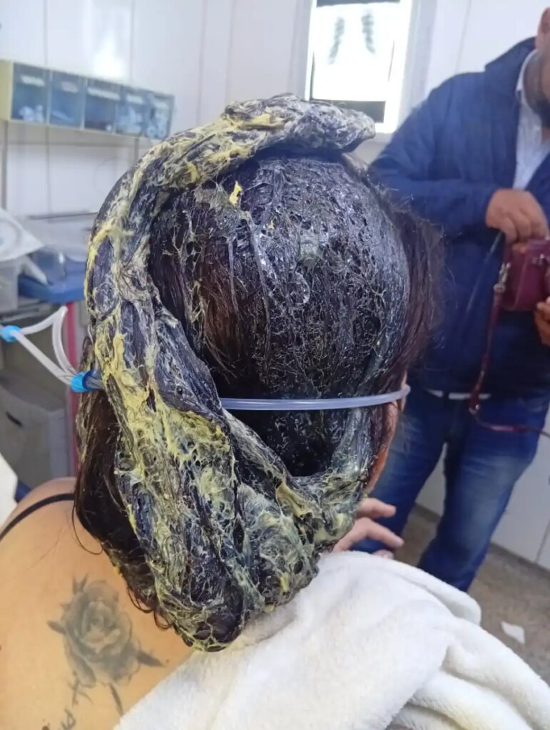 PJC: Peluquero golpeó a su pareja y le derramó cola de zapatero antes de huir